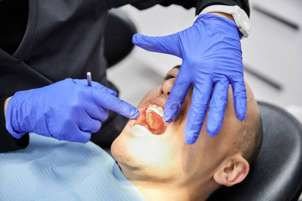 Best Teeth Whitening  in Stockton, UT